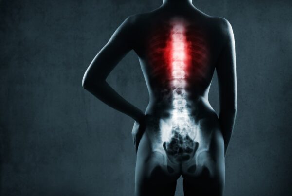 Spinal Cord Injury Lawyer in New Orleans, LA