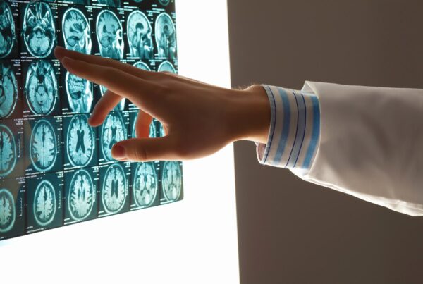 brain injury lawyer Chalmette, LA