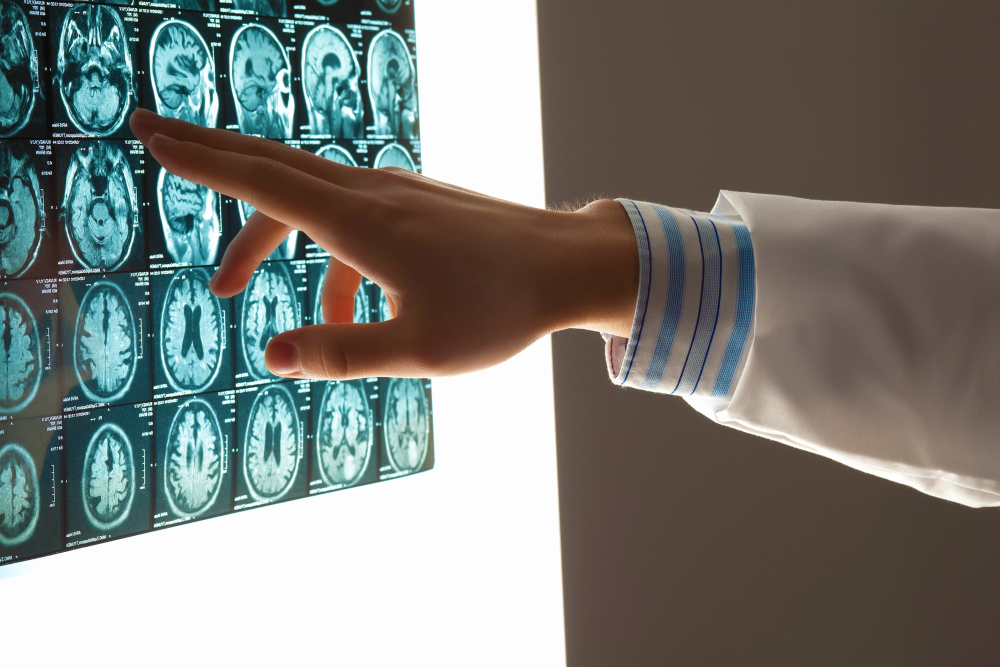 brain injury lawyer Chalmette, LA