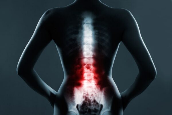 spinal cord injury lawyer New Orleans, LA