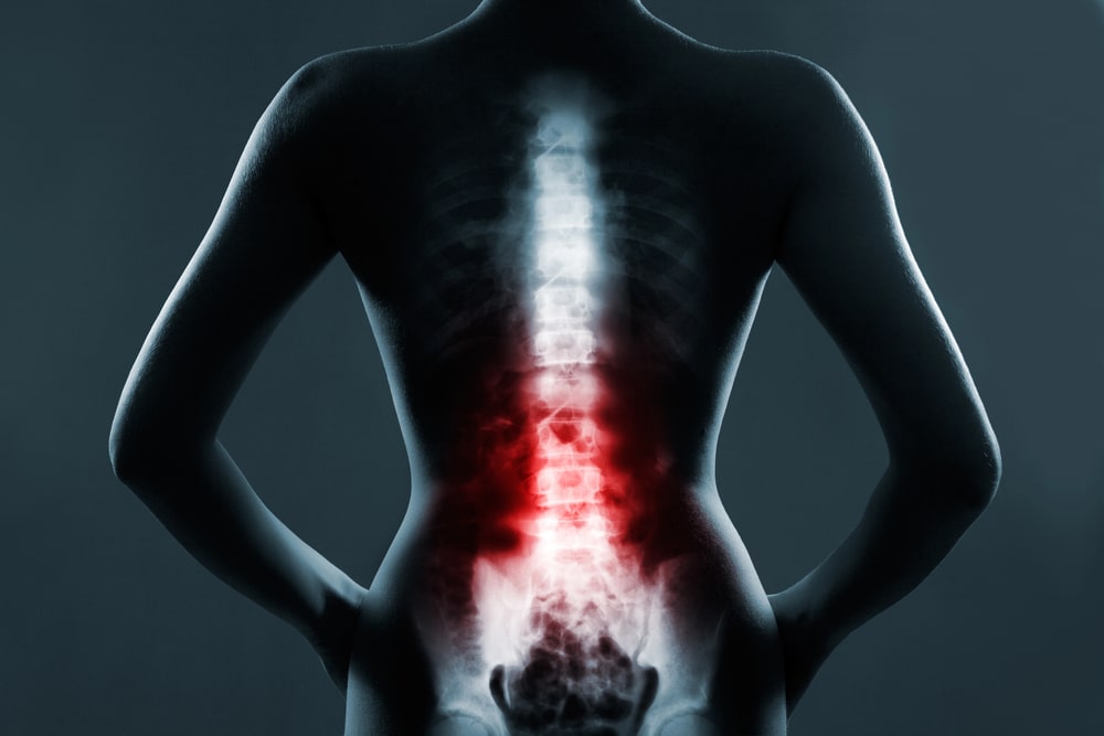 spinal cord injury lawyer New Orleans, LA